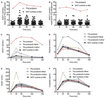 Clinical and Physiological Characterization of Elevated Plasma Glucagon-Like Peptide-1 Levels (Hyperglipemia) in a Dipeptidyl Peptidase IV Mutation Carrier